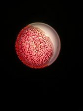 Dry blood under a microscope 4.jpg