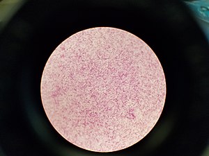 Microbiology gram stain.jpg