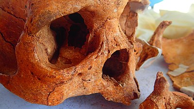 Dead human skull.jpg